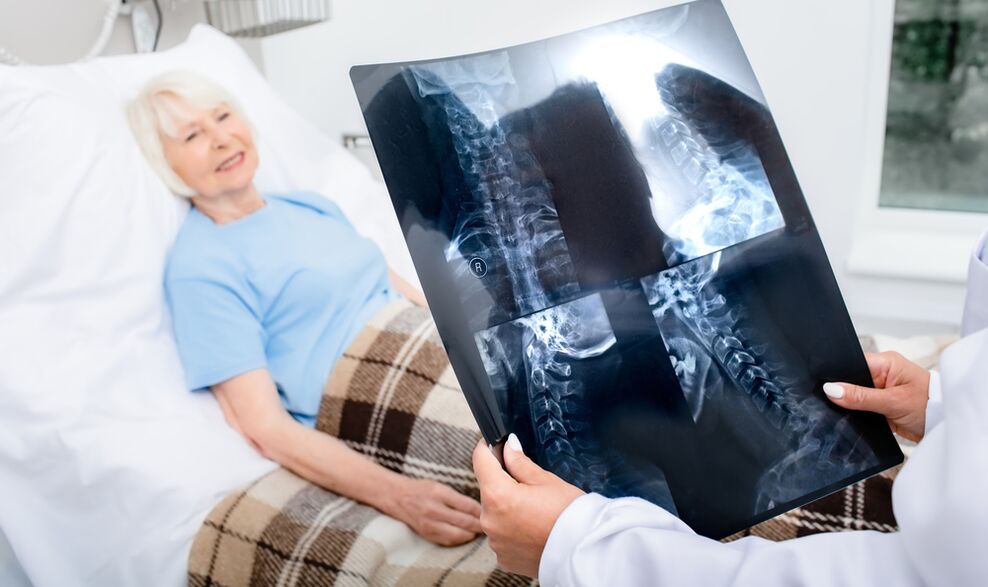 osteohondrozes diagnostika