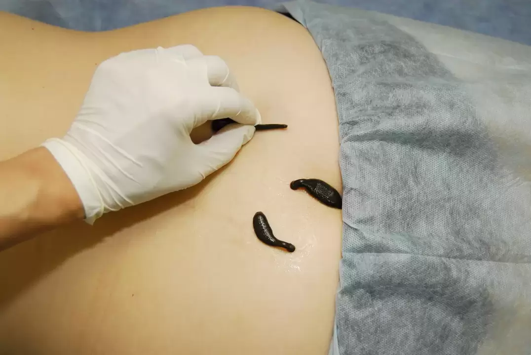 dēles novietošana jostas daļas osteohondrozes gadījumā