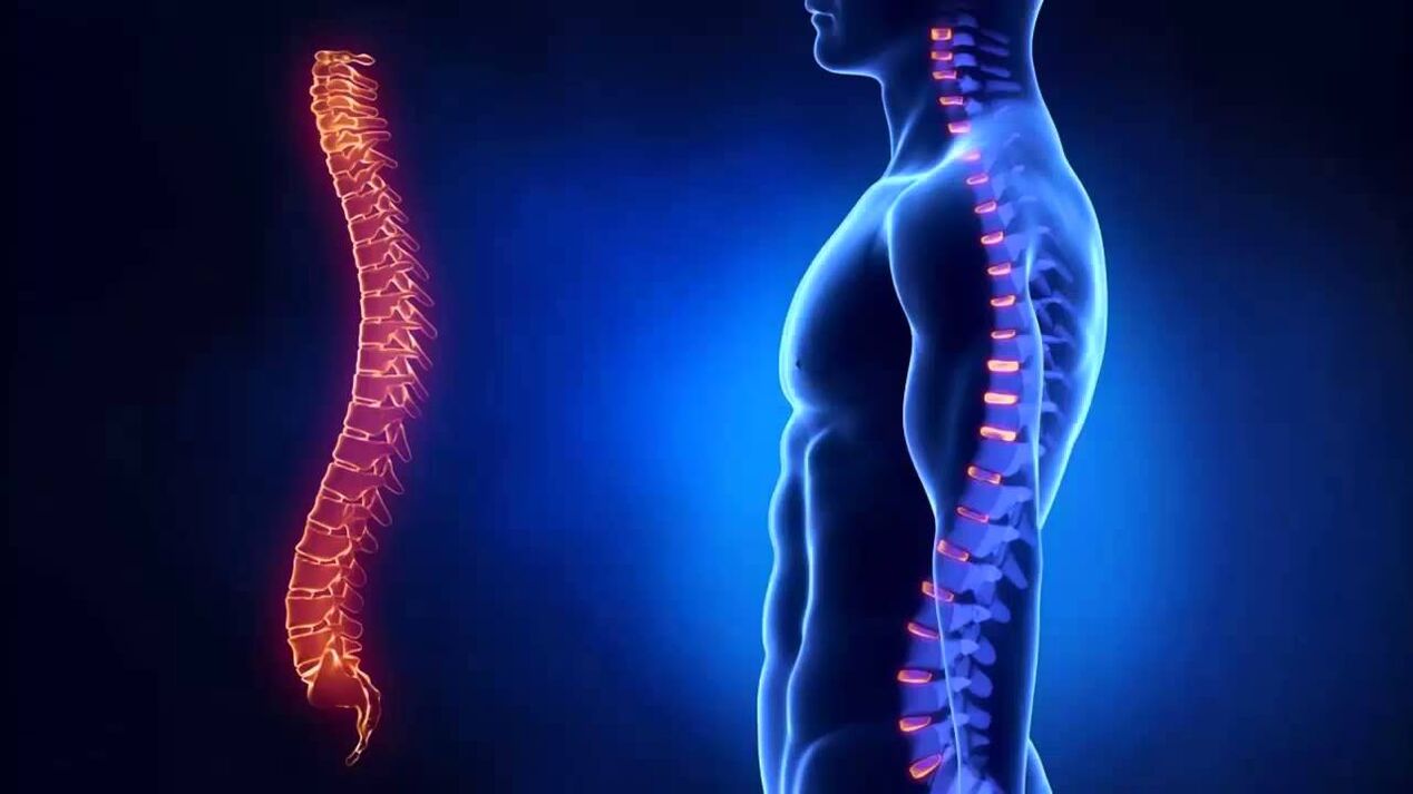 osteohondroze